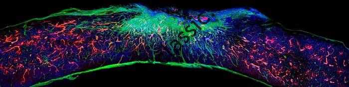 ترمیم / بازسازی سلول های عصبی آسیب دیده ستون فقرات